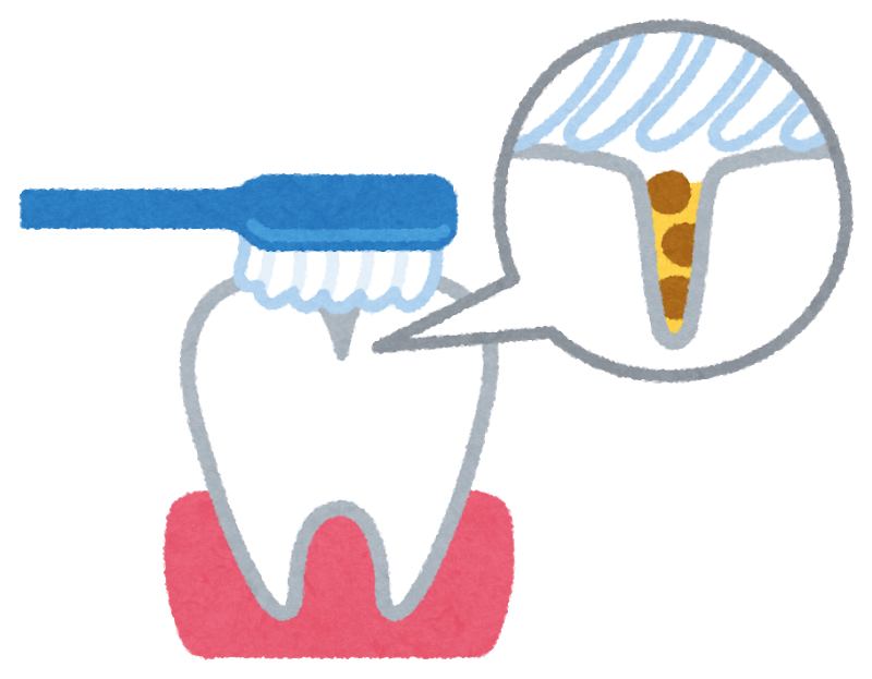 予防歯科の福岡市西区姪浜駅南の歯科医院りんご歯科